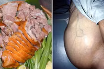 Khiếp sợ những căn bệnh do món khoái khẩu thịt chó gây ra