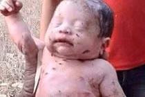 Thần kỳ sự sống sót em bé bị đâm, chôn sống