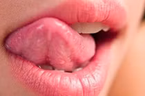 Không thể ngờ sát thủ âm thầm gây ung thư miệng