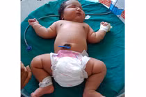 Bé gái sơ sinh 6,8kg nặng nhất thế giới chào đời