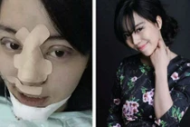 Sau sinh, gái trẻ 9X phẫu thuật “vịt hóa thiên nga“