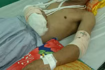 Nhắc nhở "tè bậy", thanh niên bị chém dã man