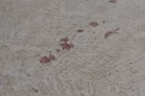 Dã man em chồng chém xối xả vào chị dâu