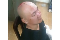 Va quệt xe, thanh niên cầm dao lao vào ẩu đả