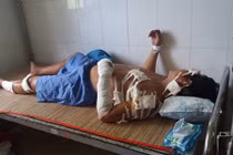 Nghi ngoại tình, vợ múa dao chém chồng gần 20 nhát