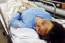 Nghị lực của nữ sinh bị tạt axit từng gây chấn động 