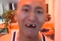 Chàng trai mất răng vì chơi “ngu” ăn ngô bằng máy khoan