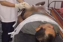 Phát hiện em trai bị tai nạn nguy kịch khi xem Facebook