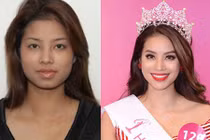 Khuôn mặt gây tranh cãi dao kéo của Hoa hậu Phạm Thị Hương