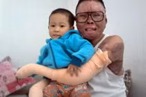 Chiến sỹ duy nhất sống sót trong vụ rơi máy bay tại Hòa Lạc giờ ra sao?