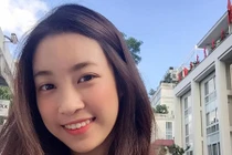 Những mỹ nhân có nụ cười hở lợi... vạn người mê