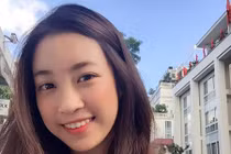 Những mỹ nhân có nụ cười hở lợi... vạn người mê