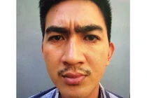 Dụ gái bán dâm vào khách sạn rồi chích điện cướp tài sản