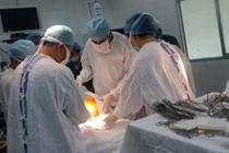 Cứu sống người đàn ông mặt biến dạng vì bệnh gút