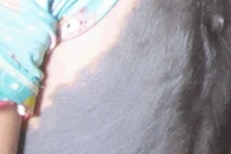 Nỗi đau của cô bé “da trâu” bị mẹ cha ruồng bỏ