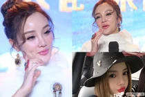 Sao Hoa ngữ mặt biến dạng khi tiêm botox quá đà