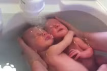 Xúc động cặp sinh đôi không biết mình đã chào đời