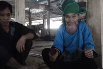 Xót xa cụ bà ở Hà Giang khổ sở vì lưỡi khổng lồ