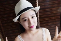 Gái xinh hói đầu vì ăn ngô bằng máy khoan giờ ra sao?