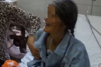 Choáng váng khi bóc lớp da bị chai dưới gót chân bị hoại tử 