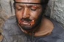 Kinh sợ bắt được gã trai “ma cà rồng” hút máu chó