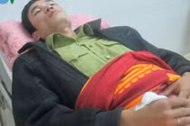 Lời kể kinh hoàng của kiểm lâm viên bị lâm tặc hành hung