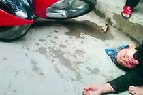 Phẫn nộ con dâu cũ đánh mẹ chồng xưa nhập viện