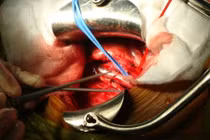 Gay cấn kế hoạch dụ siêu “cò” buôn nội tạng 9X ra mặt