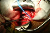 Gay cấn kế hoạch dụ siêu “cò” buôn nội tạng 9X ra mặt