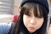 Kinh ngạc cô gái sứt môi “vịt hóa thiên nga” nhờ dao kéo