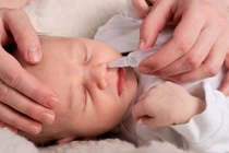 Cẩn trọng khi dùng nước muối sinh lý chăm sóc trẻ