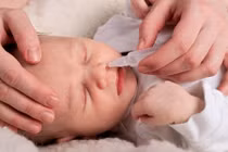 Cẩn trọng khi dùng nước muối sinh lý chăm sóc trẻ