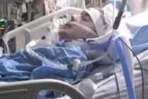 Hy hữu: Thanh niên vai u thịt bắp mất mạng vì răng sâu