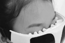 Thực hư máy massage “thổi bay” cận thị?