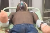 Thiếu niên bị chặt hai tay vì hiếp dâm bé 8 tháng tuổi