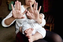 Lạ kỳ bé trai có 16 ngón chân ở Trung Quốc