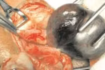 Nghịch dại hạt “ngọc”, bé trai biến thành “thái giám“