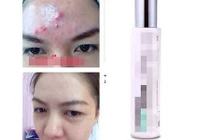 Bí quyết làm đẹp da bằng đá quý khiến chị em "điên đảo"