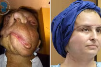 Kinh ngạc khi gặp lại người phụ nữ mang “gương mặt quỷ” 