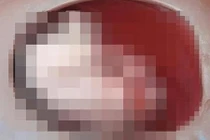 Sốc: Sản phụ đẻ rơi con xuống bồn cầu mới biết mình mang thai