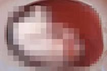 Sốc: Sản phụ đẻ rơi con xuống bồn cầu mới biết mình mang thai