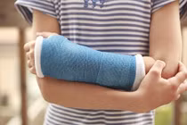 Cậu bé bị gãy xương do rối loạn tiêu hóa