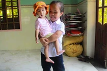 Nữ sinh mang hình hài trẻ lên 5 ước mơ thành cô giáo