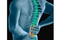 Gai cột sống bẩm sinh liệu có bị liệt khi sinh con?