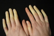 Thấy biểu hiện này ở cơ thể phải đi khám ngay