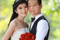 Hạnh phúc khó tin của kiều nữ và chàng trai mặt bị biến dạng