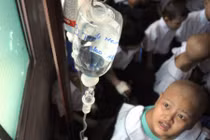 Một số loại ung thư của trẻ em và cách phát hiện sớm