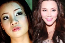 Sao Việt đua nhau phẫu thuật thẩm mỹ để thay đổi vận mệnh