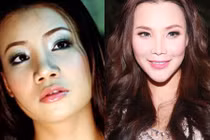 Sao Việt đua nhau phẫu thuật thẩm mỹ để thay đổi vận mệnh