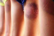 Thừa Thiên - Huế: Một thầy giáo bị tố đánh đập học sinh